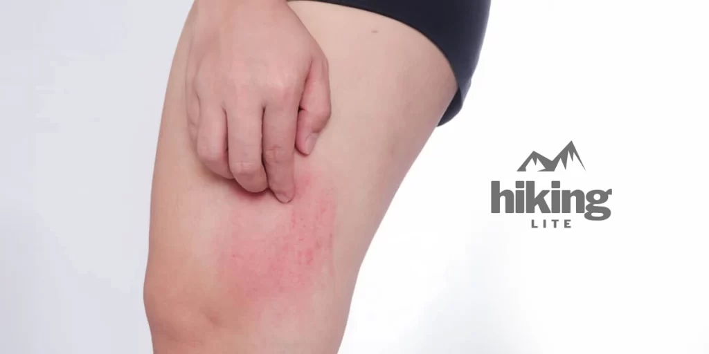 A close up of a chafed thigh